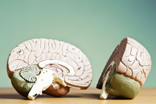 Schwindel – Ursachen, Symptome und häufige Erkrankungen im Überblick Gehirnmodell als Symbolbild für zentrale neurologische Ursachen von Schwindel